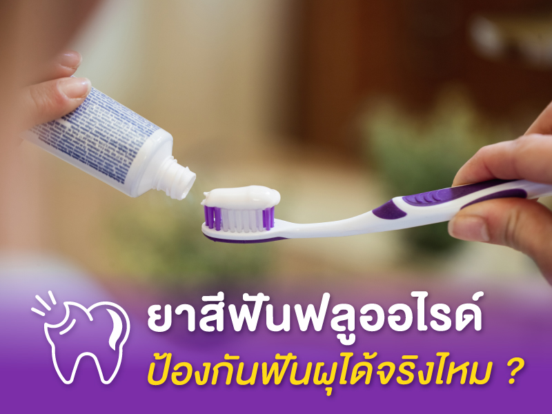 ยาสีฟันฟลูออไรด์ ป้องกันฟันผุได้จริงไหม ? 